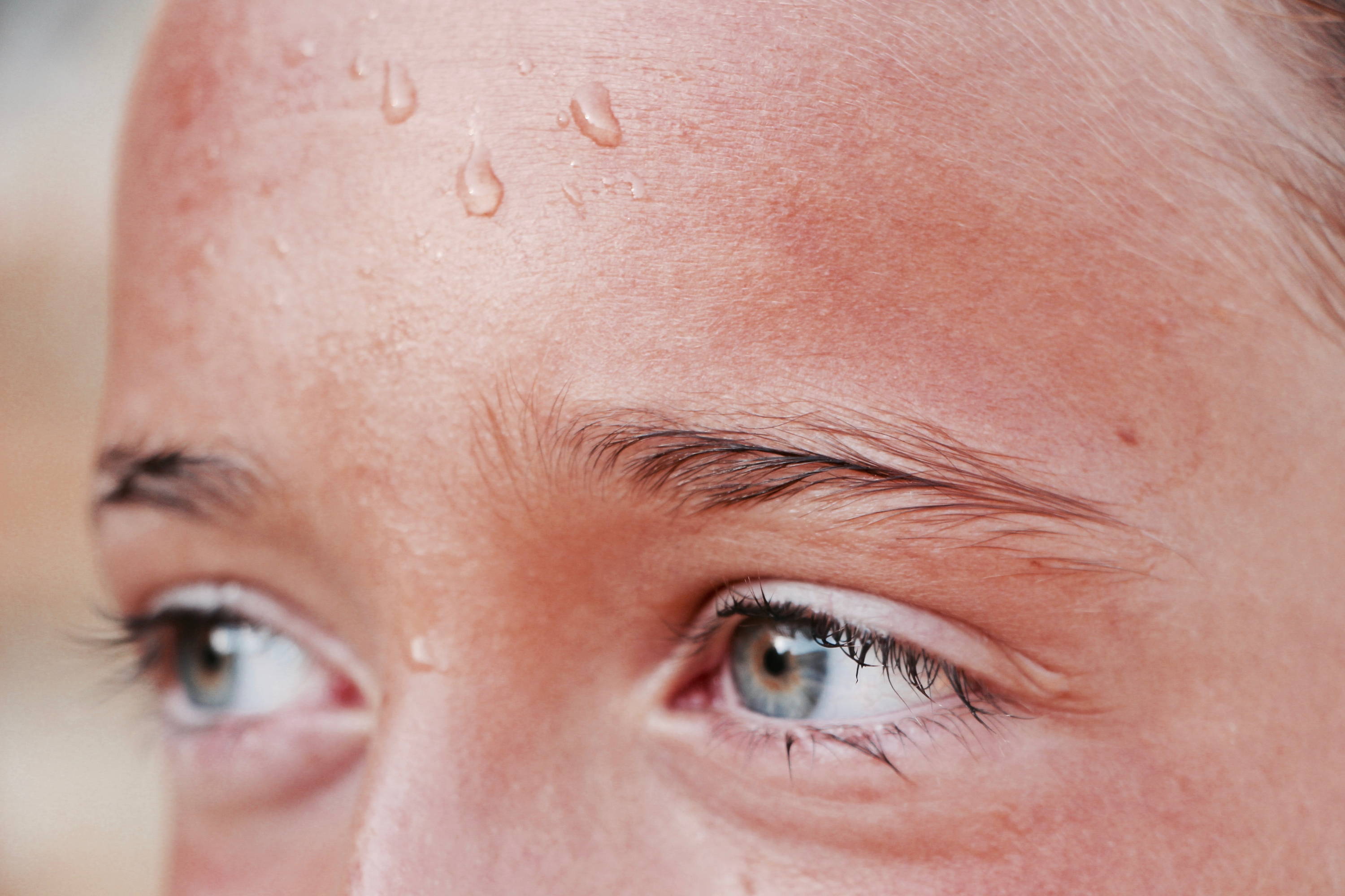 Closeup image of a person's forehead covered with sweat