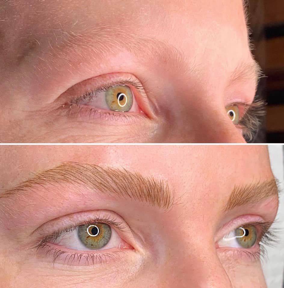 Scalp Microblading Near Me / The cuts in the skin damage ...