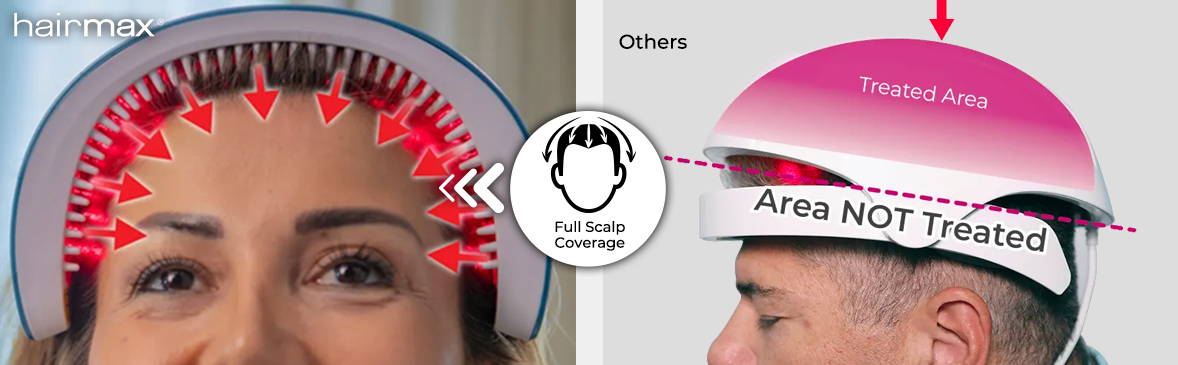 full scalp coverage