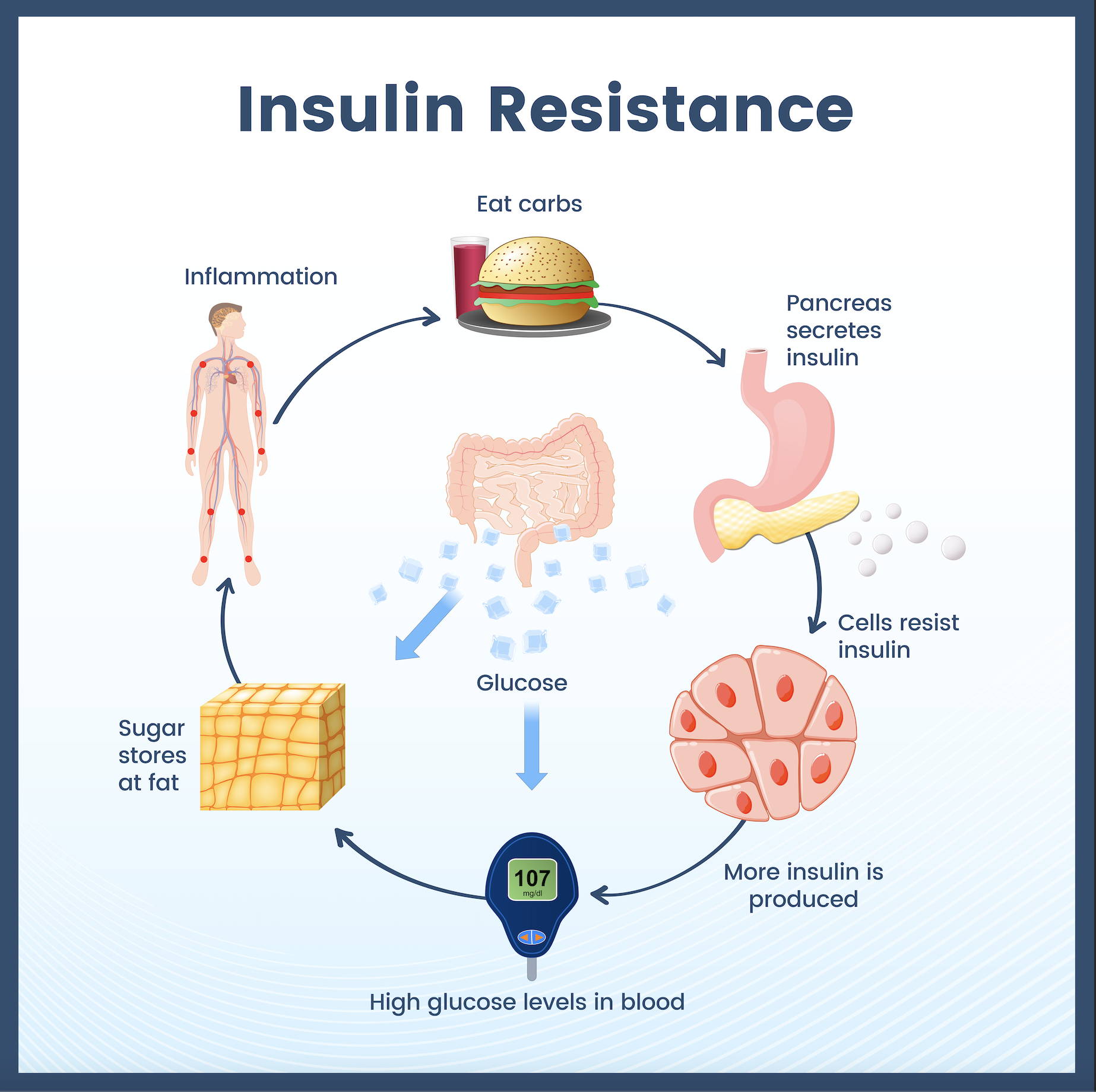 Graphic showing the steps of developing insulin resistance.
