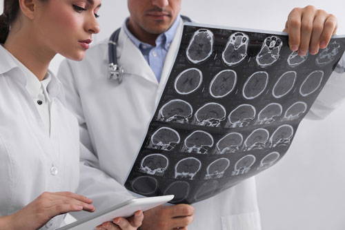 doctors looking at scan MS diagnosis