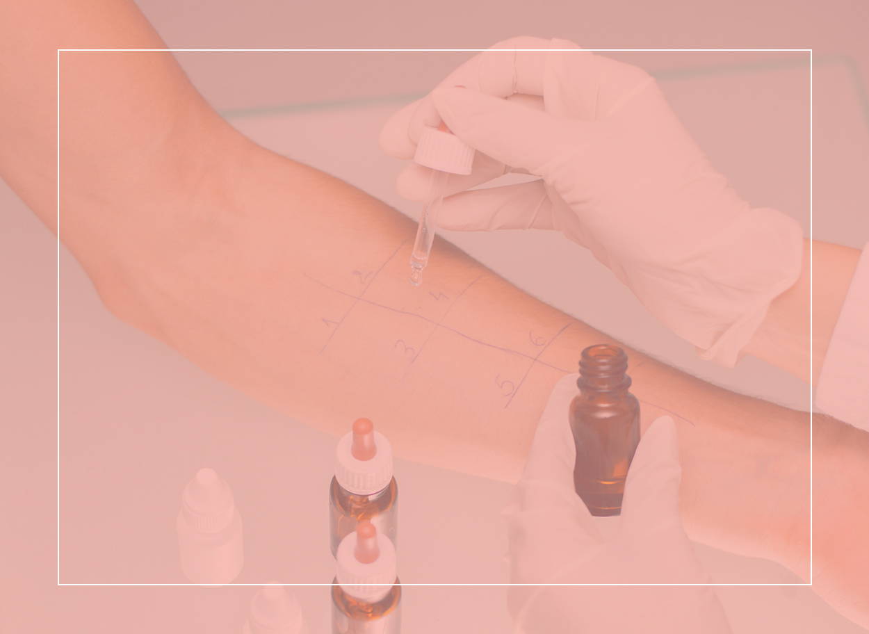 Someone having a skin prick test on their forearm – a white-gloved hand puts drops of liquid into a grid drawn on the skin