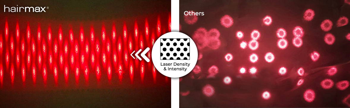 Laser density