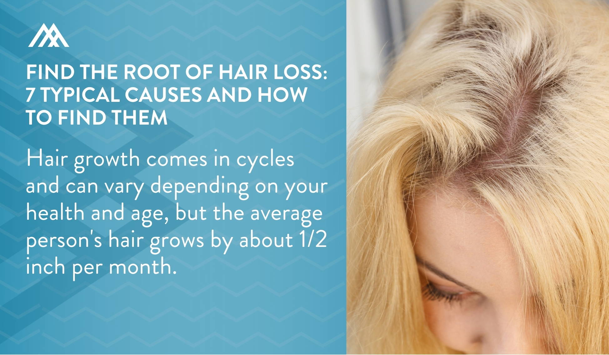 Find The Root Of Hair Loss 7 Typical Causes And How To Spot Them Amandean