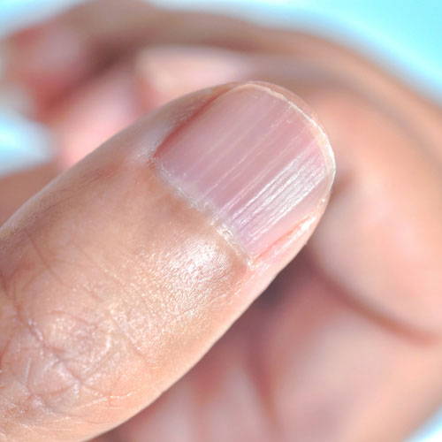 Common Nail Problems & How to Improve Your Nail Health Naturally - Black  Chicken Remedies