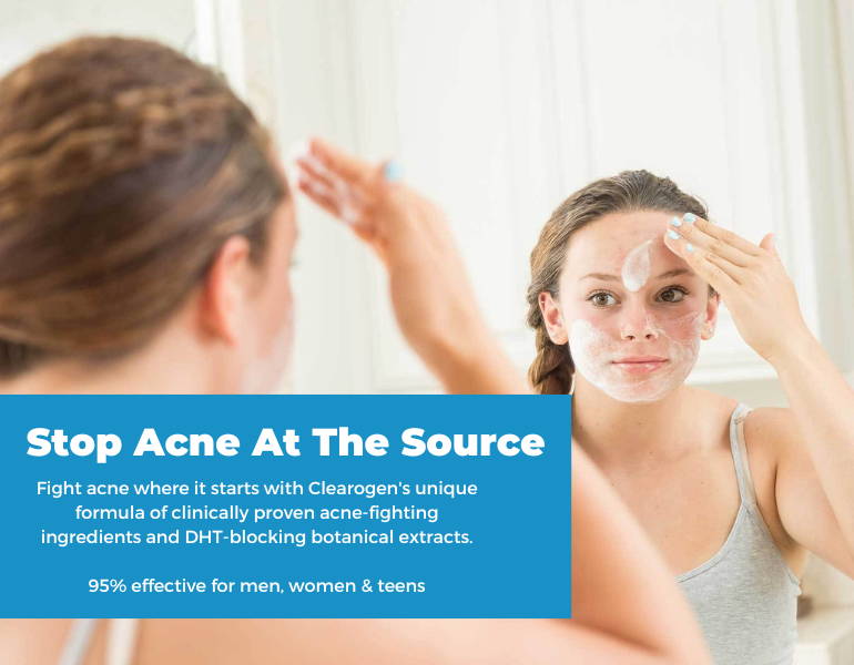 Clearogen dermatologist formulated skincare for acne prone skin