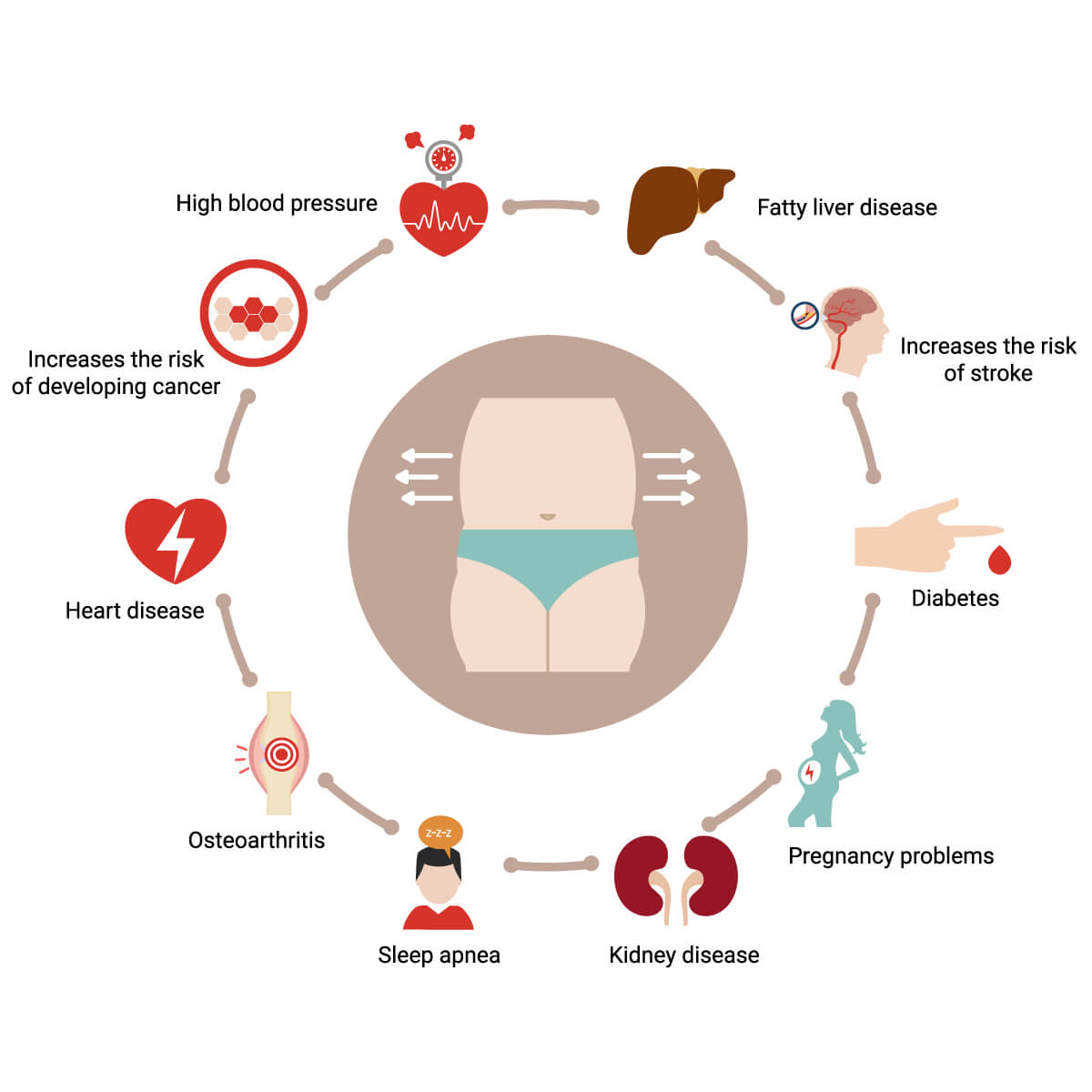 Diagram illustrating health risks associated with obesity and related conditions.