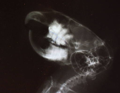 X-ray 2 of teeth Image