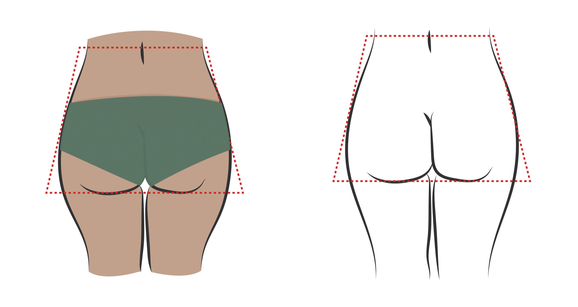 Square Butt Cheeks