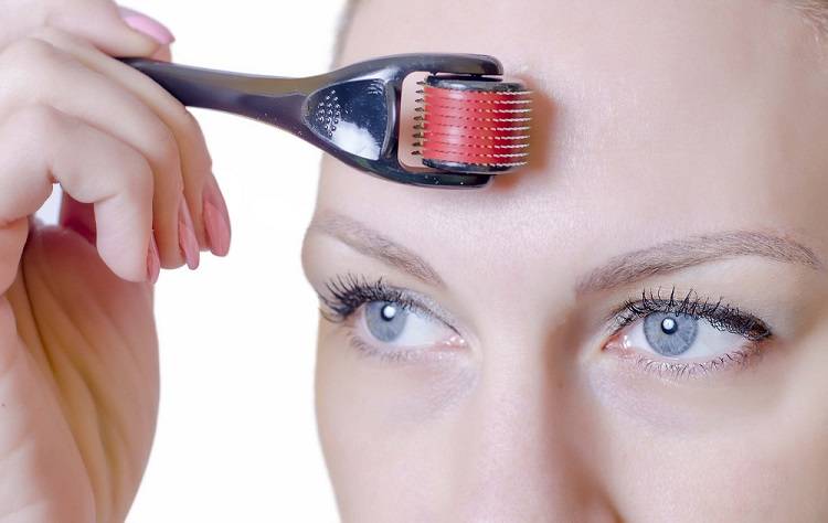 Derma Roller Microneedling for Acne-Prone Skin
