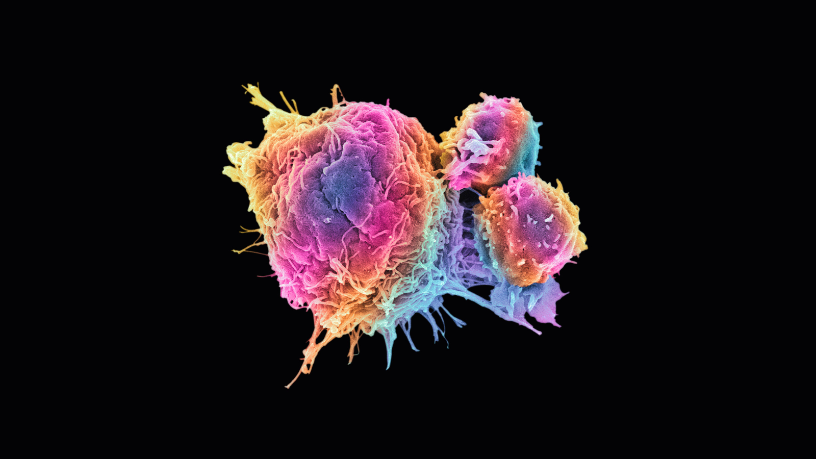 Colourful, computer generated image of T lymphocytes attached to cancer cell