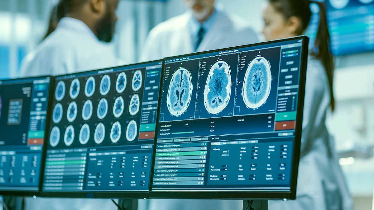 Team of Medical Scientists in the Brain Research Laboratory | How To Increase Neurogenesis | Cognitive function