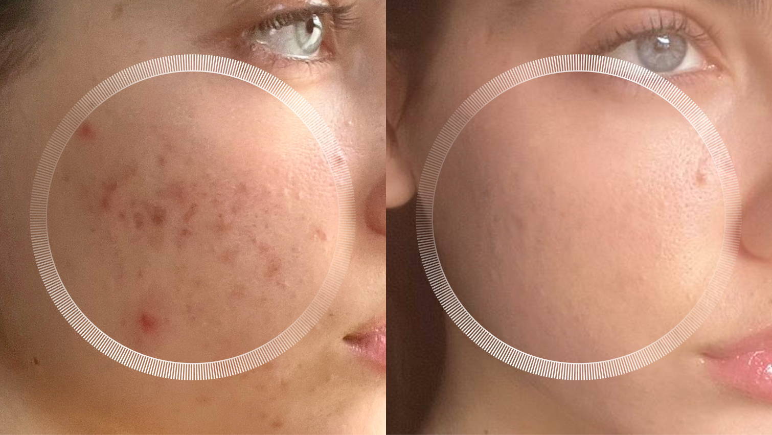 #seo: Before and After beauty tech