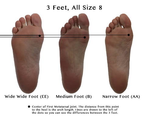 feet too wide for birkenstocks