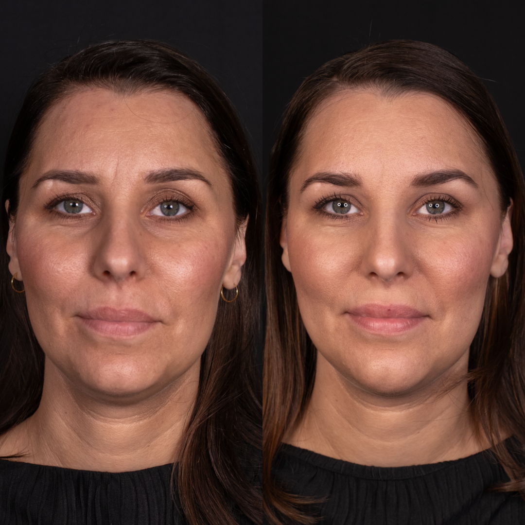 Before and after makeup application on a woman's face.