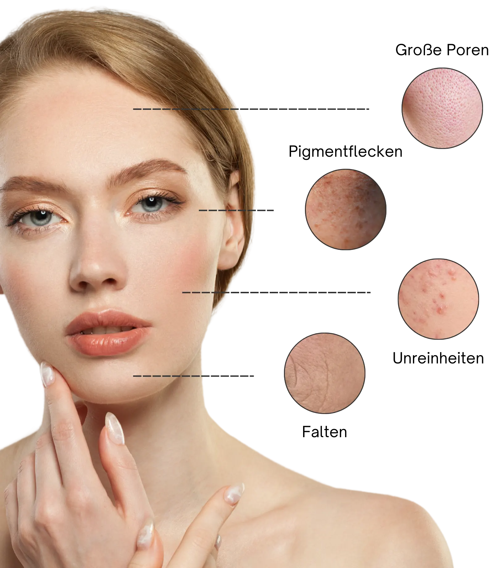 Active Serum als Lösung für Hautprobleme: Akne, Pigmentflecken, Große Poren, Falten