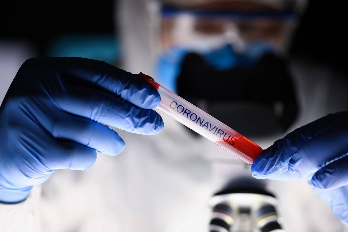 Coronavirus Test Tube held by a medical professional