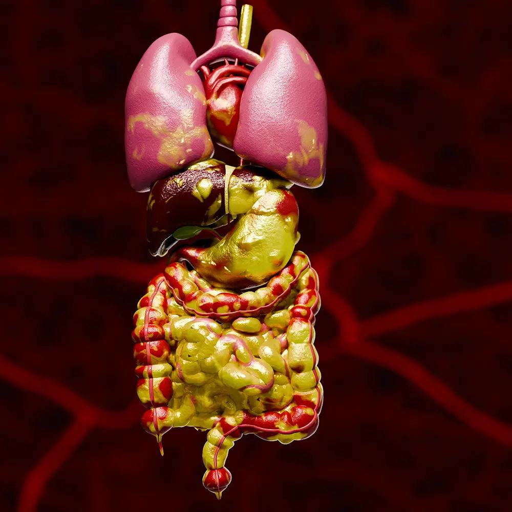 3D illustration of visceral fat around human organs including lungs and intestines.