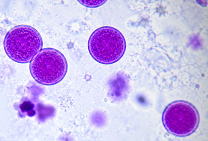 cyclospora