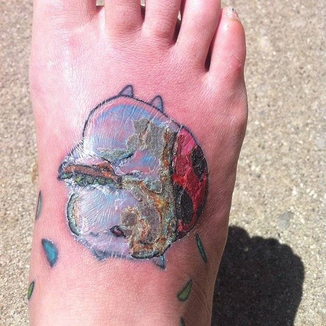 Possibly infected tattoo