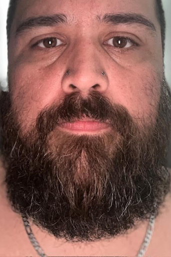 Zeus customer after using BeardPLUS products