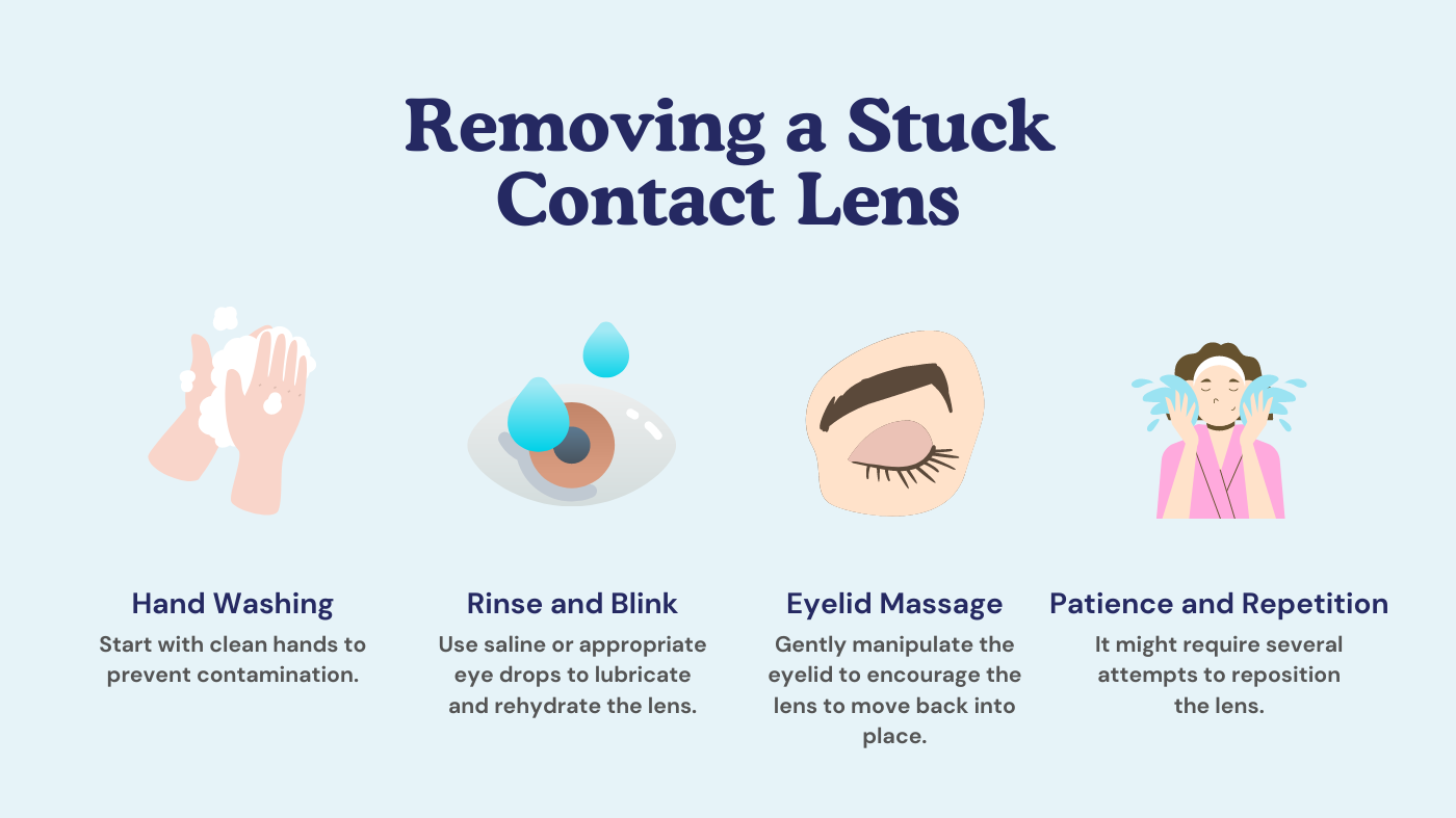 Removing a Stuck Contact Lens