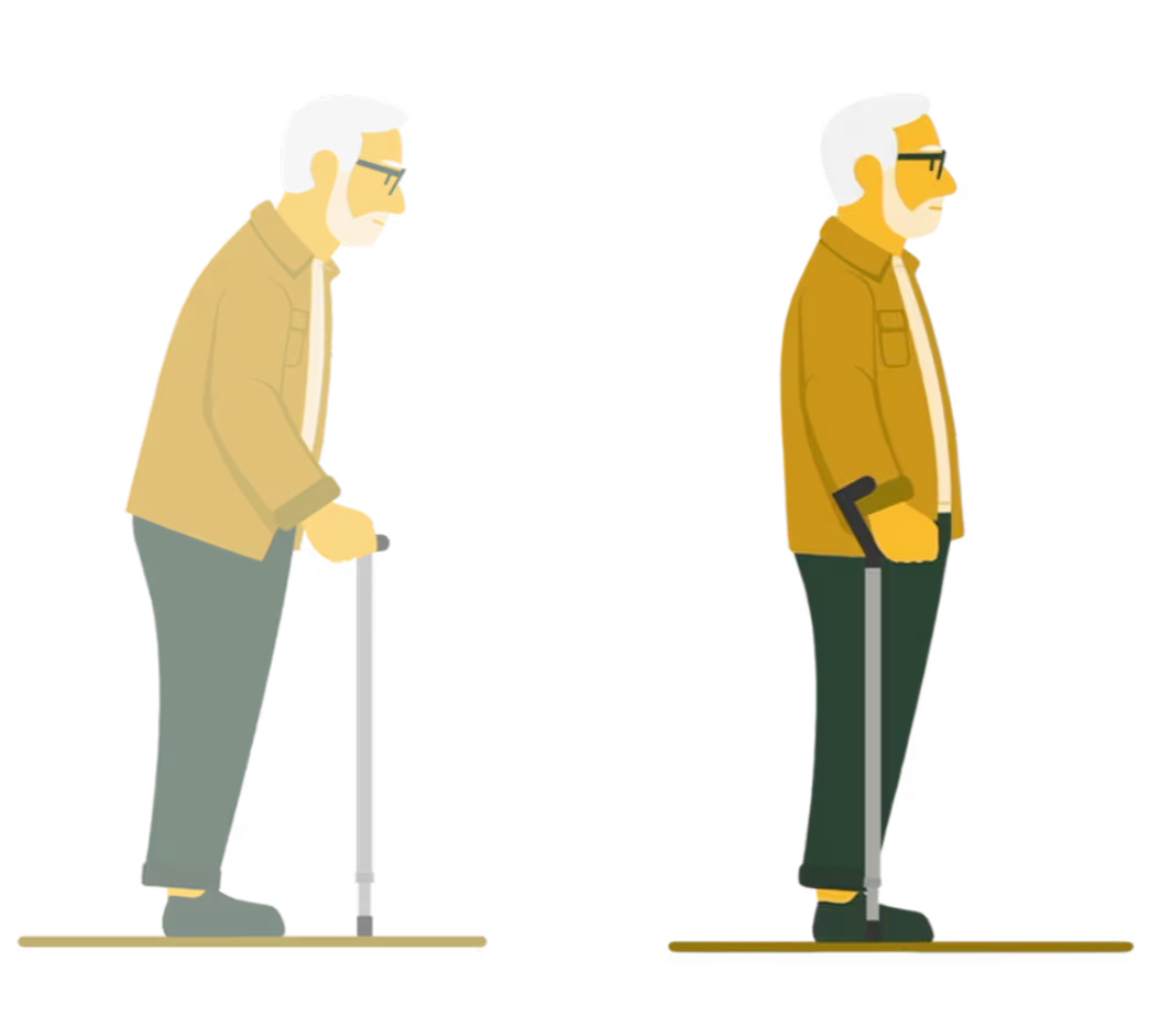 ide-by-side illustration comparing an older man hunched over a traditional cane on the left with the same man standing upright using the Y-Cane on the right