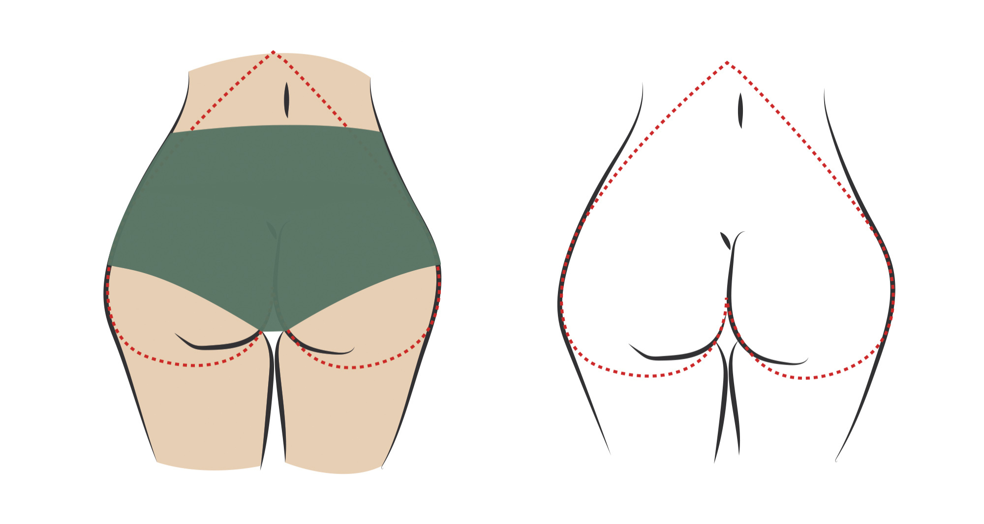 Find Your Fit: The Best Underwear For Every Butt Shape - WOO