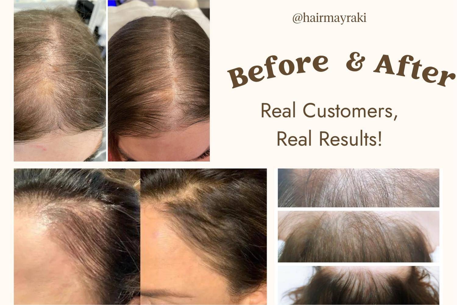 Mayraki_hair_growth_before_after1