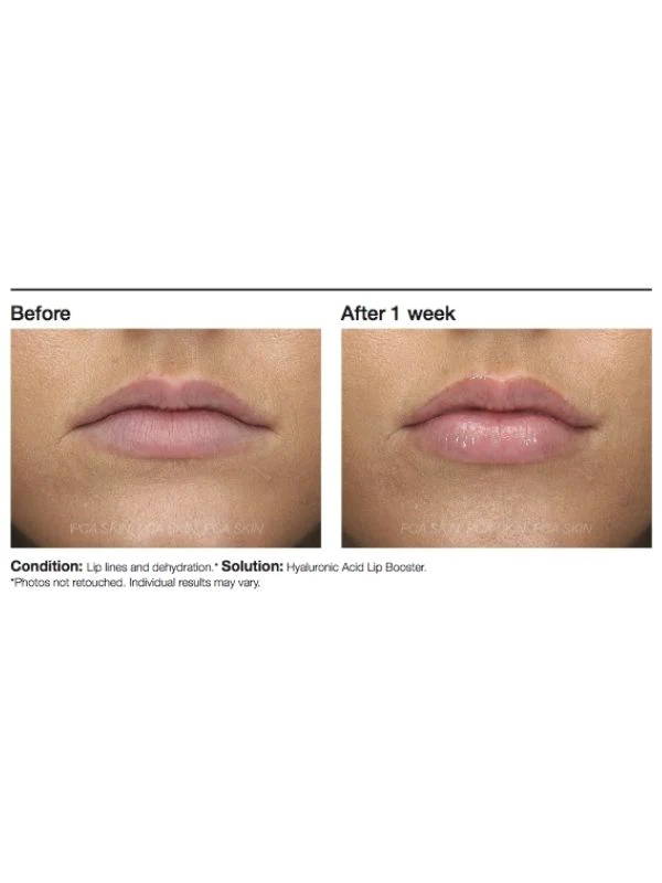 PCA Skin Hyaluronic Acid Lip Booster Before and After