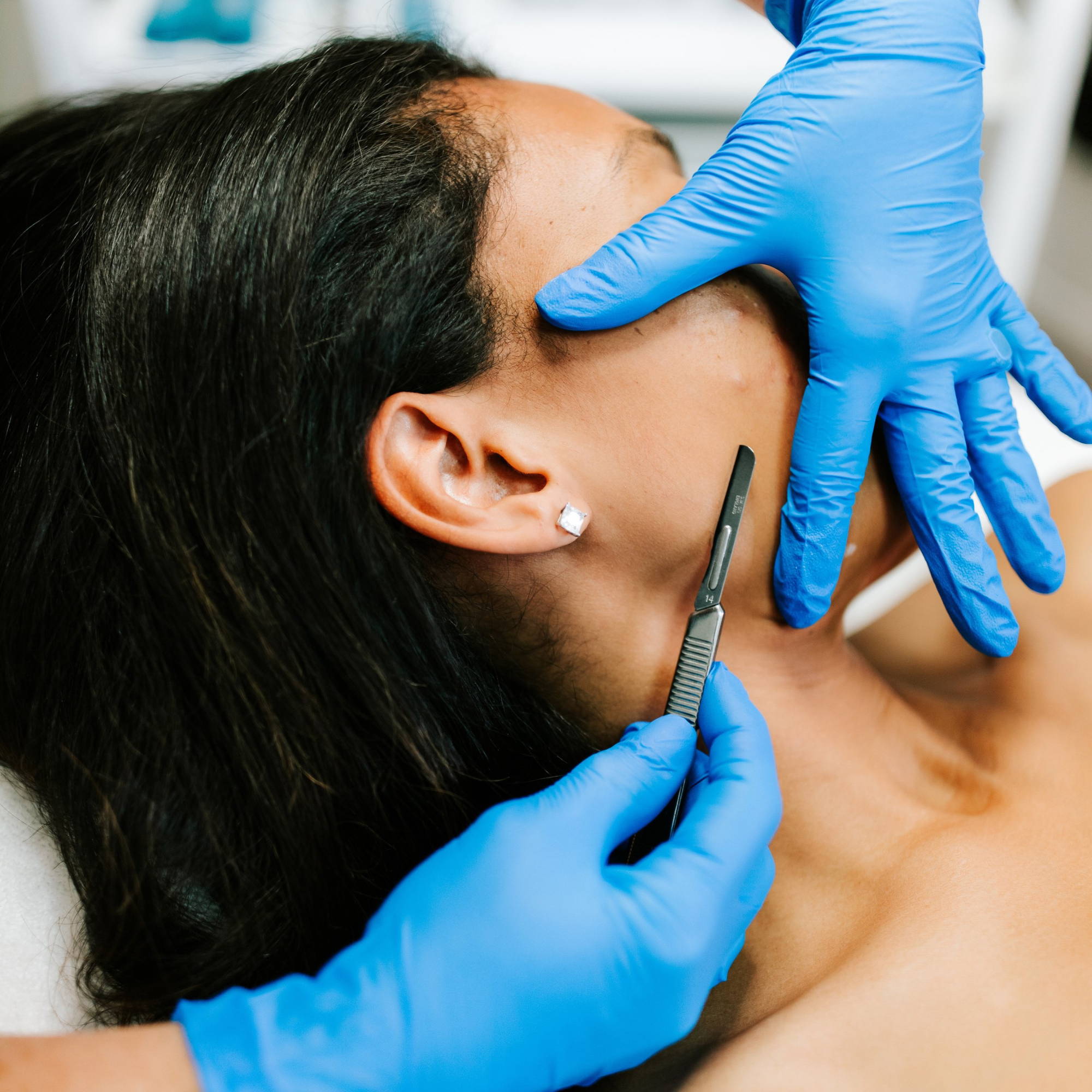 Professional esthetician dermaplaning a womans face 