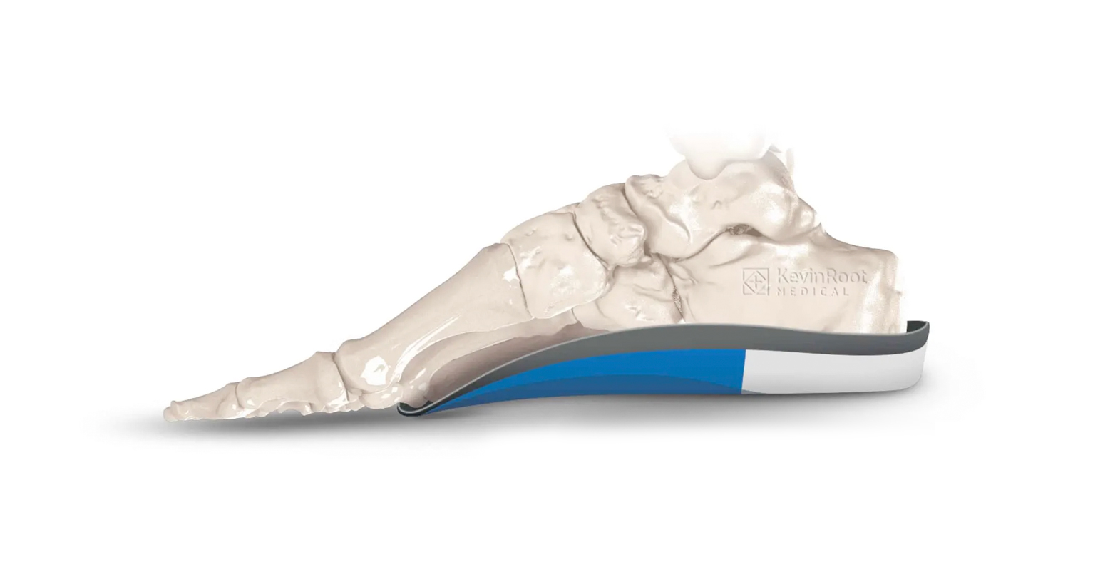 Frame Filler – KevinRoot Medical