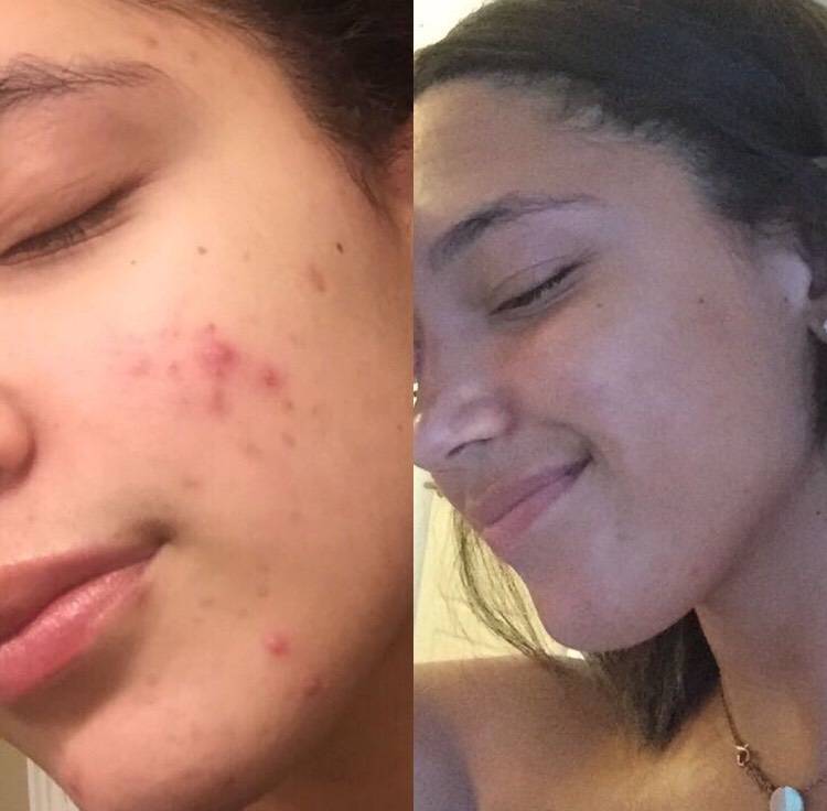 rosen skincare paloma serum