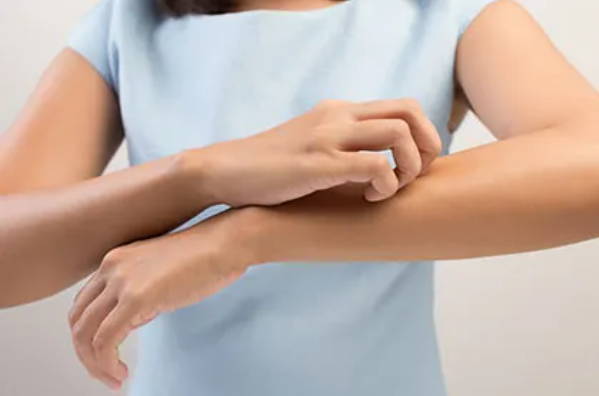 A picture of a woman scratching her arm