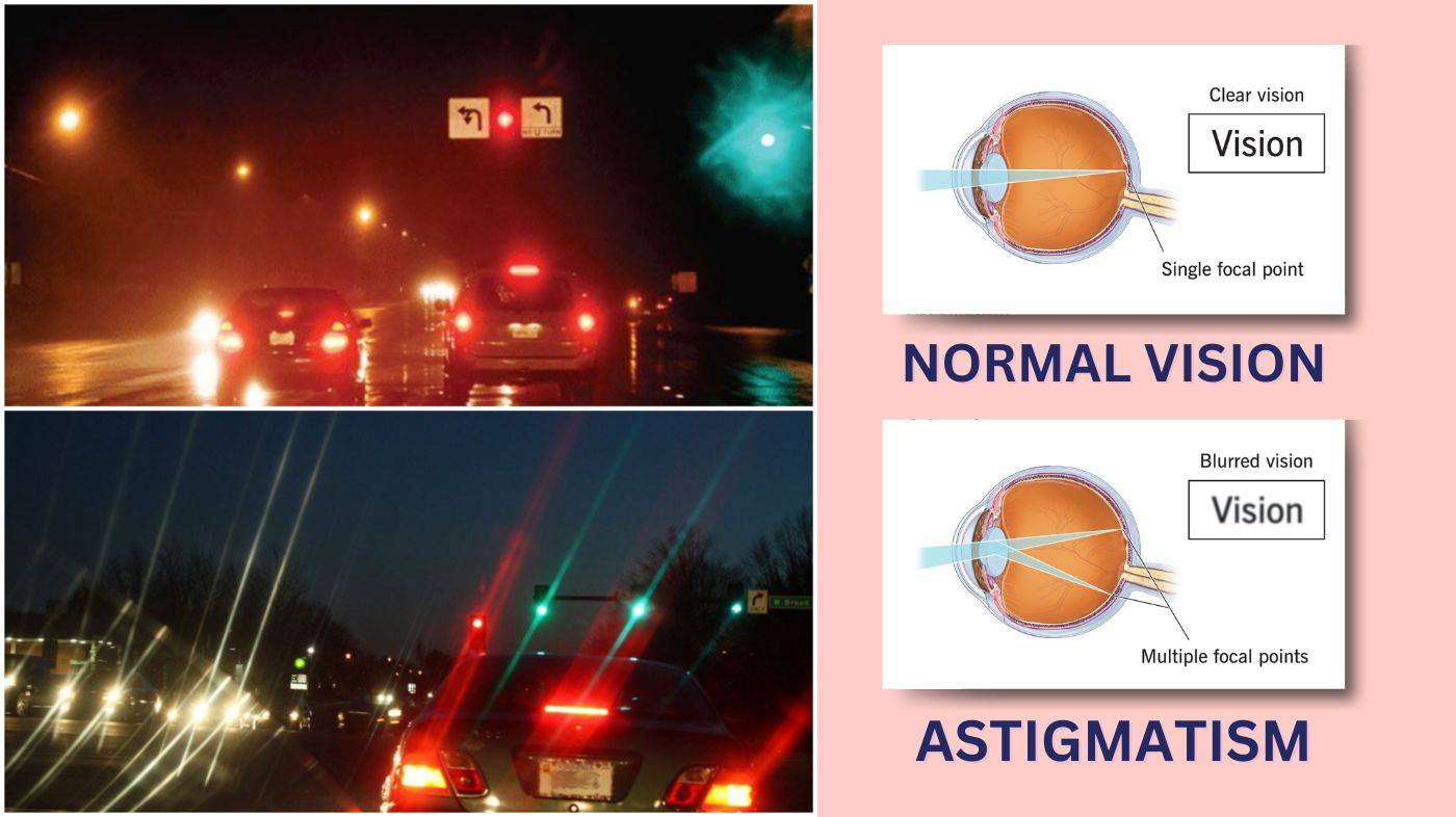 Understanding Astigmatism How It Affects Your Perception Of Lights 