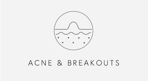 Ance & Breakouts