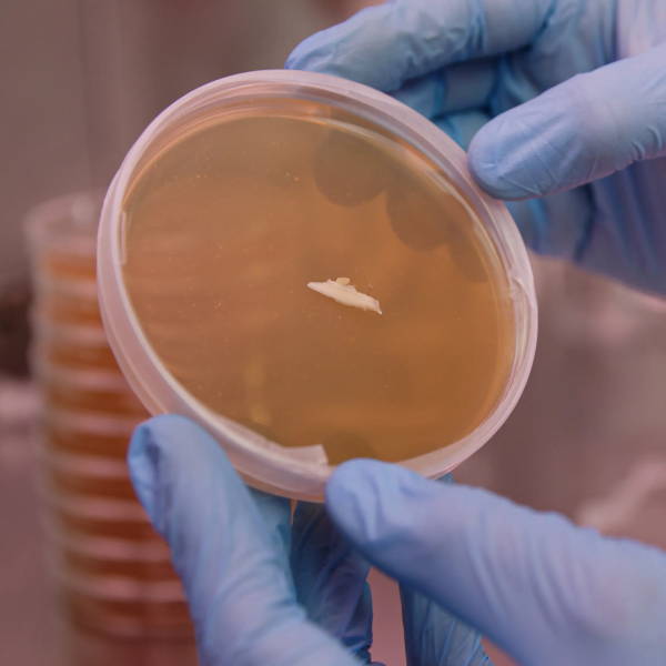 culture placed on agar petri dish