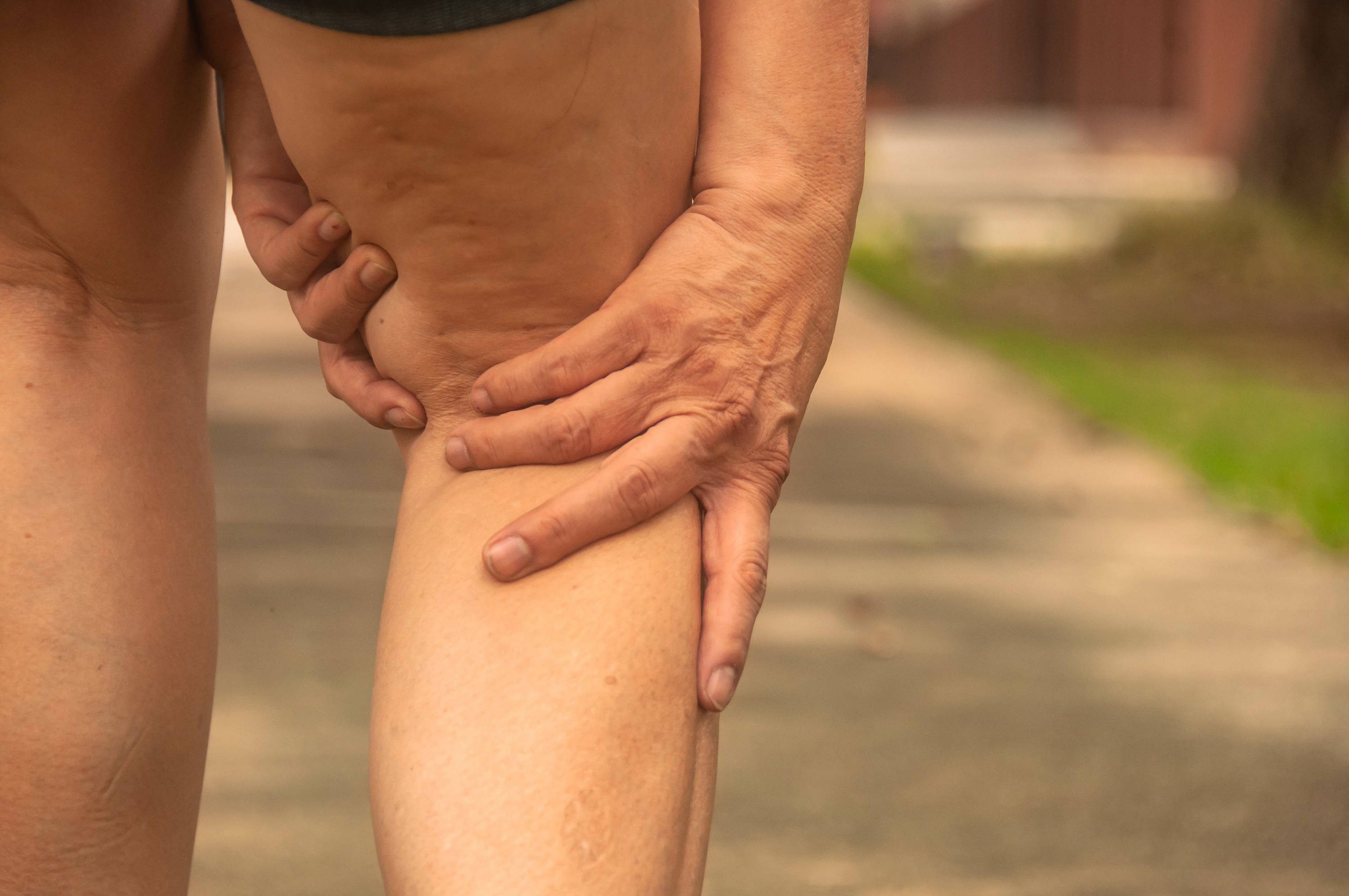 Woman holding leg, woman with leg pain