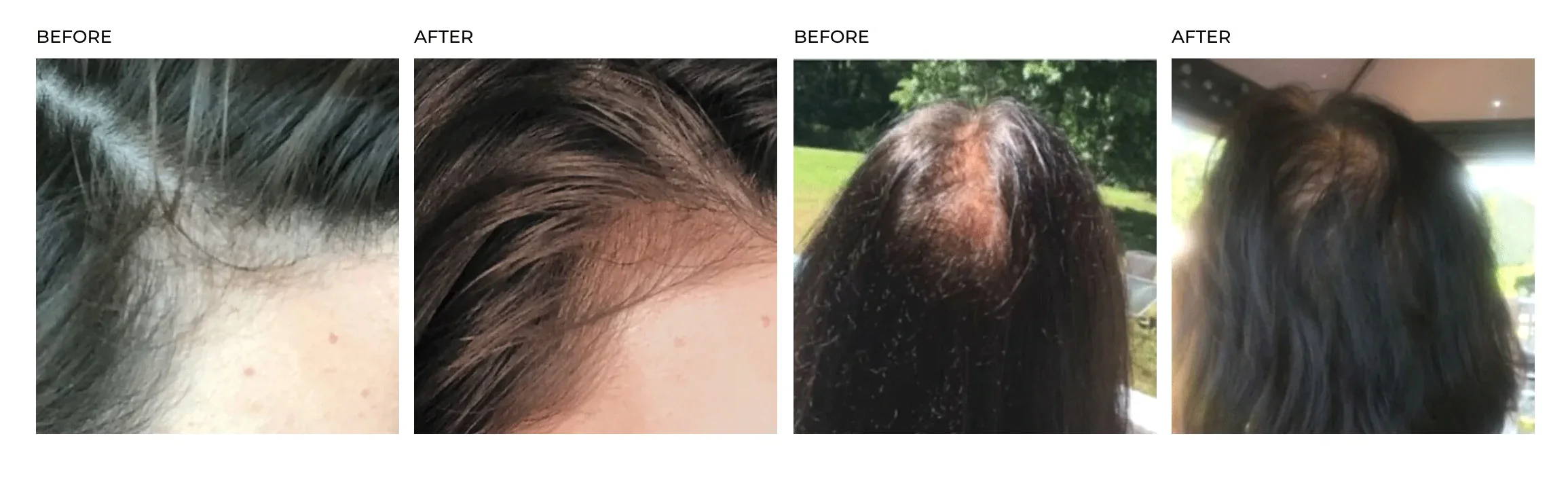 DeeplyRooted_Before_After_3