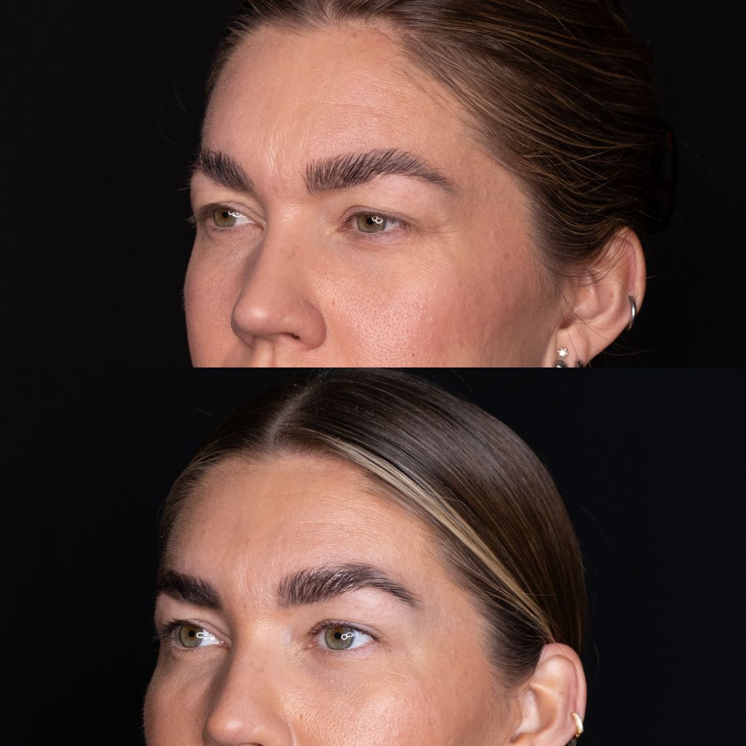 Side-by-side comparison of two different eyebrow styles on a woman.