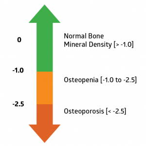 DEXA Scan - Scores & Everything You Need to Know