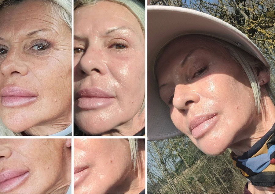 Collage of close-up selfies showing facial features and expressions.