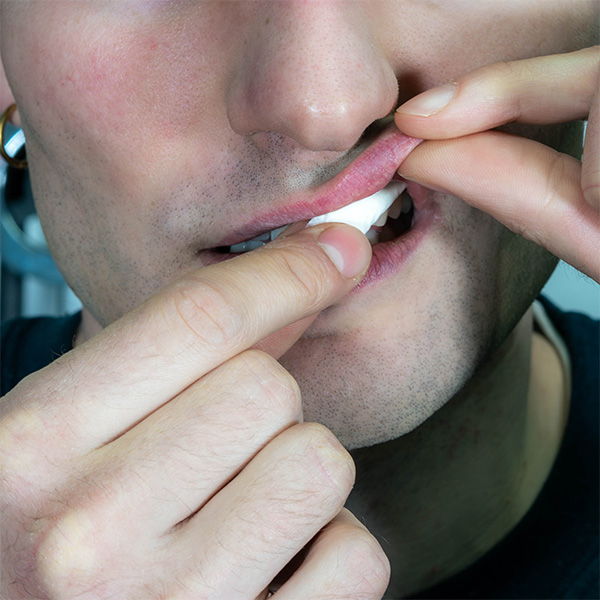 Person applying a white nicotine pouch.