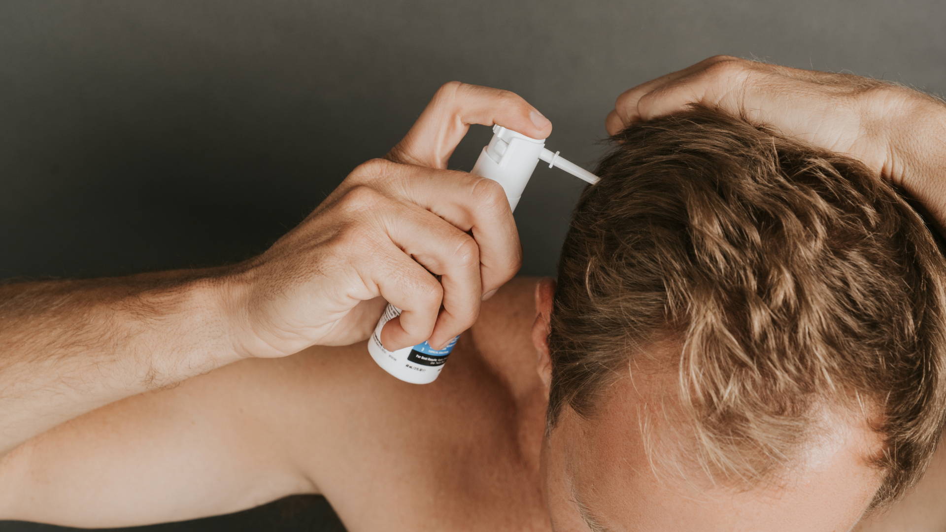 Are Minoxidil Gains Permanent for Hair Growth? – DS Healthcare Group