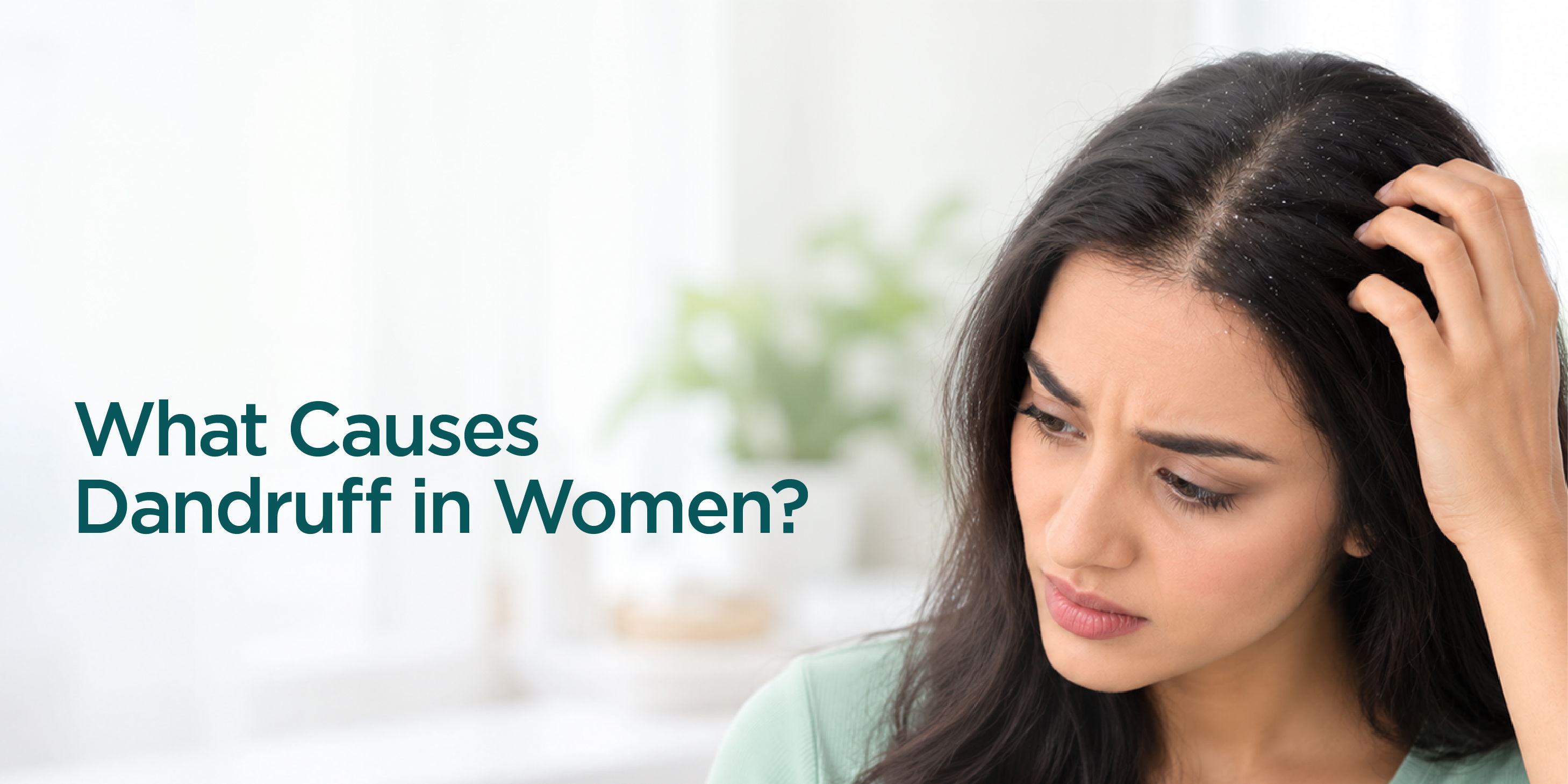 What Causes Dandruff in Women.jpg