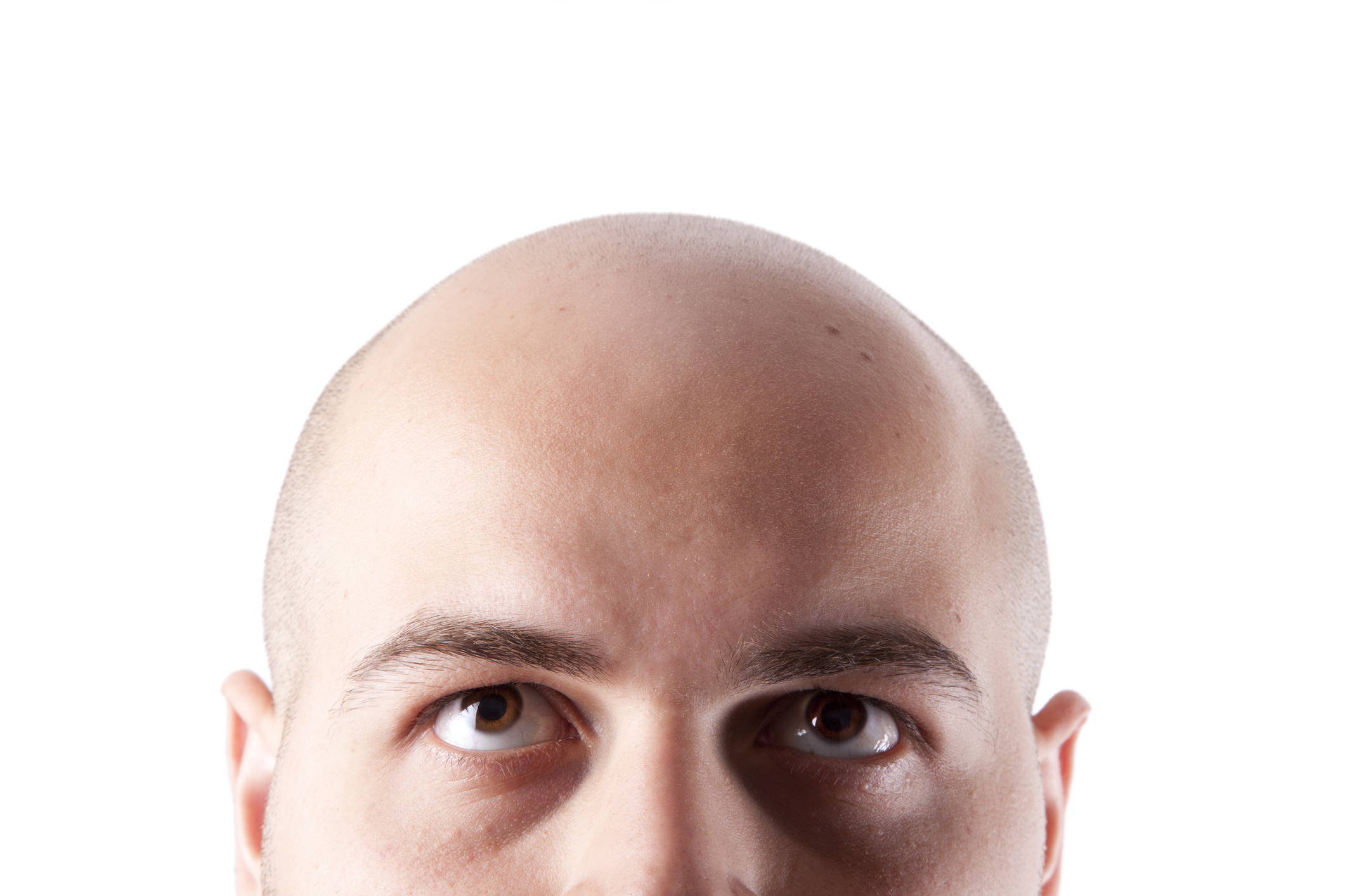 Can Minoxidil Regrow Hair in Bald Spots? – DS Healthcare Group