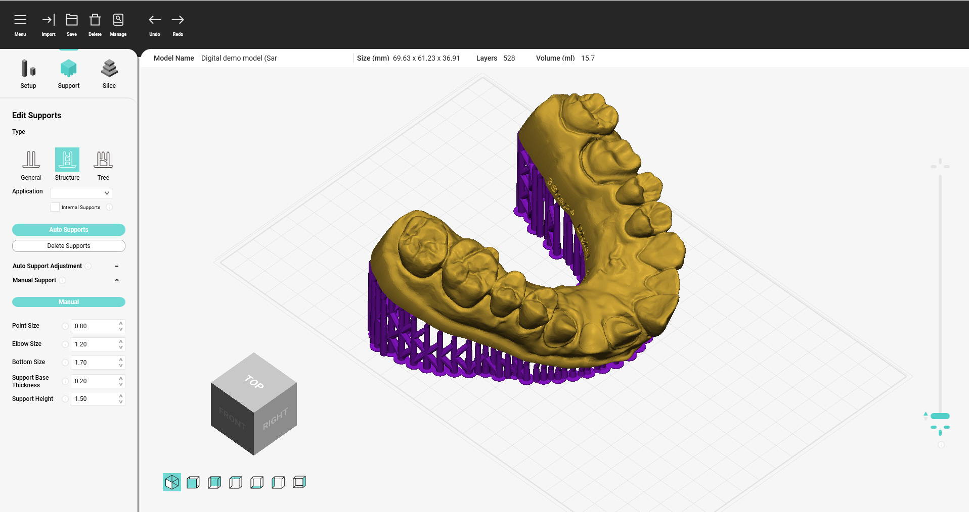 impression 3D