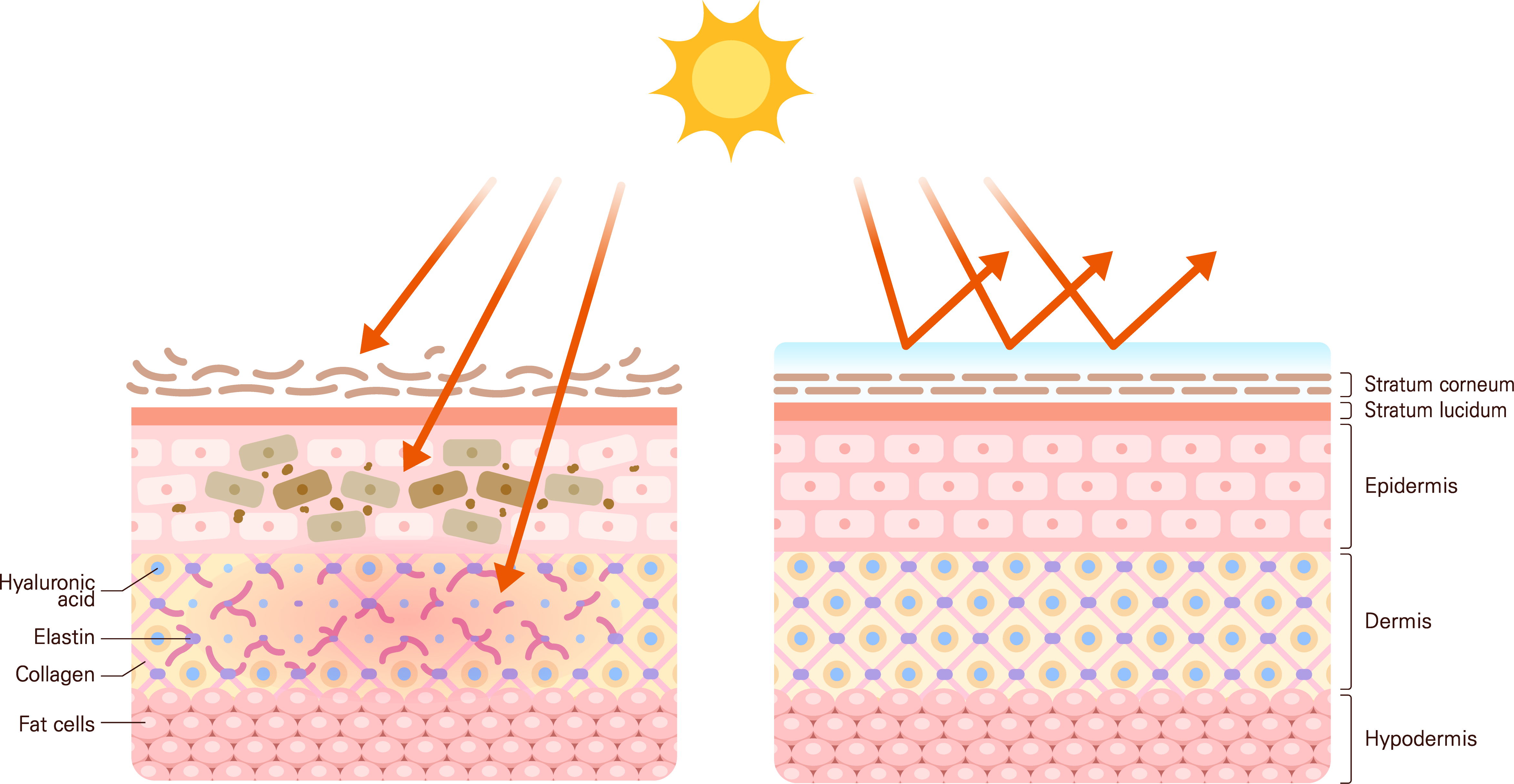 Diagram illustrating skin layers and sun damage effects.
