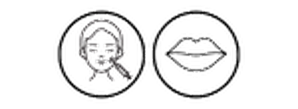 Lip filler enhancement treatment at Prolase Clinic