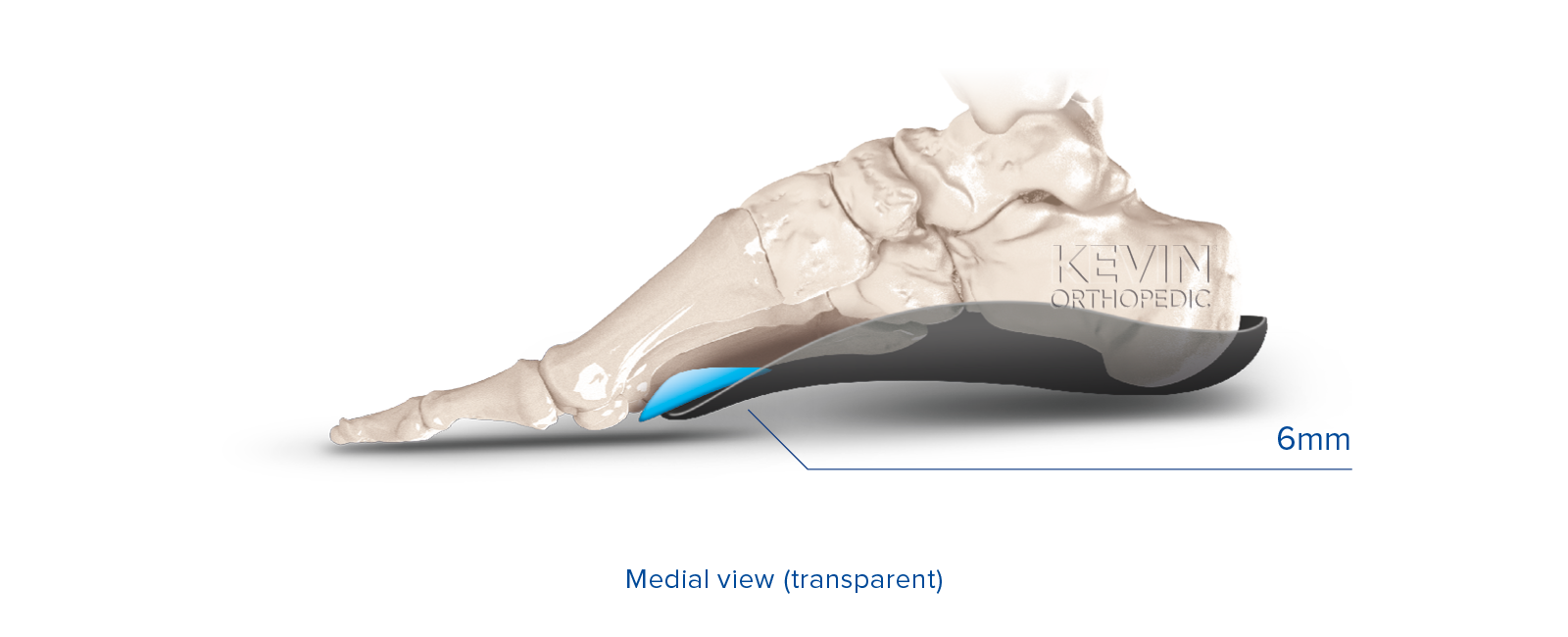 THE CLINIC GUIDE: OFFLOADING - Metatarsal Pad 2-4 – Kevin Orthopedic ...